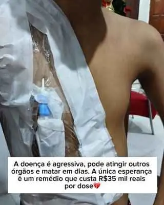 Felipe em tratamento